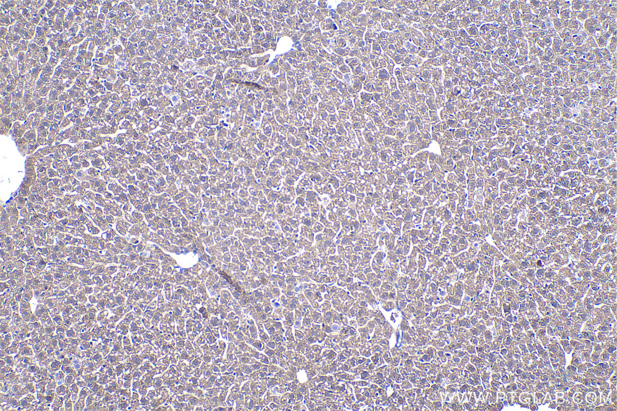 Immunohistochemical analysis of paraffin-embedded mouse liver tissue slide using KHC0522 (ADH1C IHC Kit).