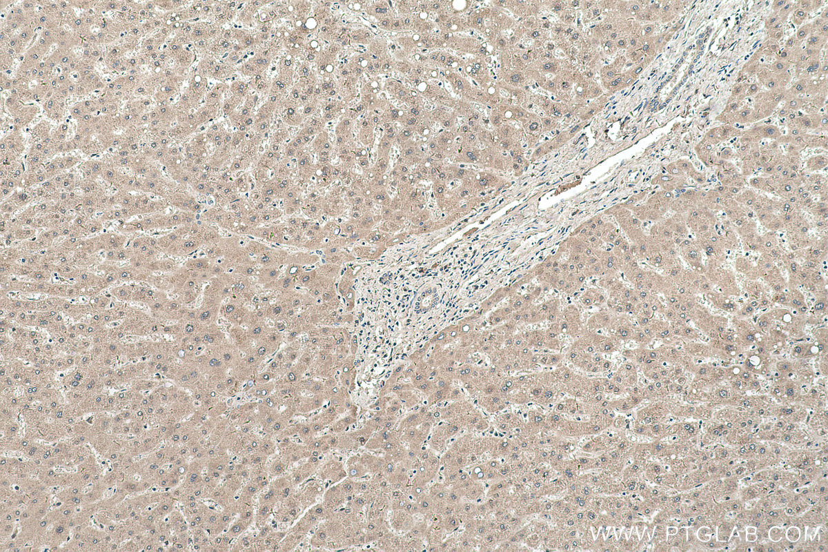 Immunohistochemical analysis of paraffin-embedded human liver tissue slide using KHC0539 (ADH6 IHC Kit).