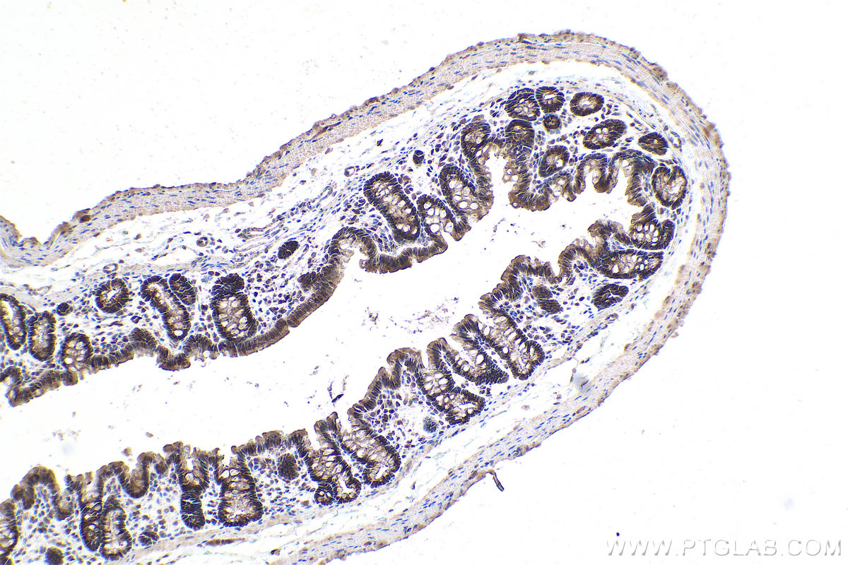 Immunohistochemical analysis of paraffin-embedded rat colon tissue slide using KHC0916 (ADI1 IHC Kit).