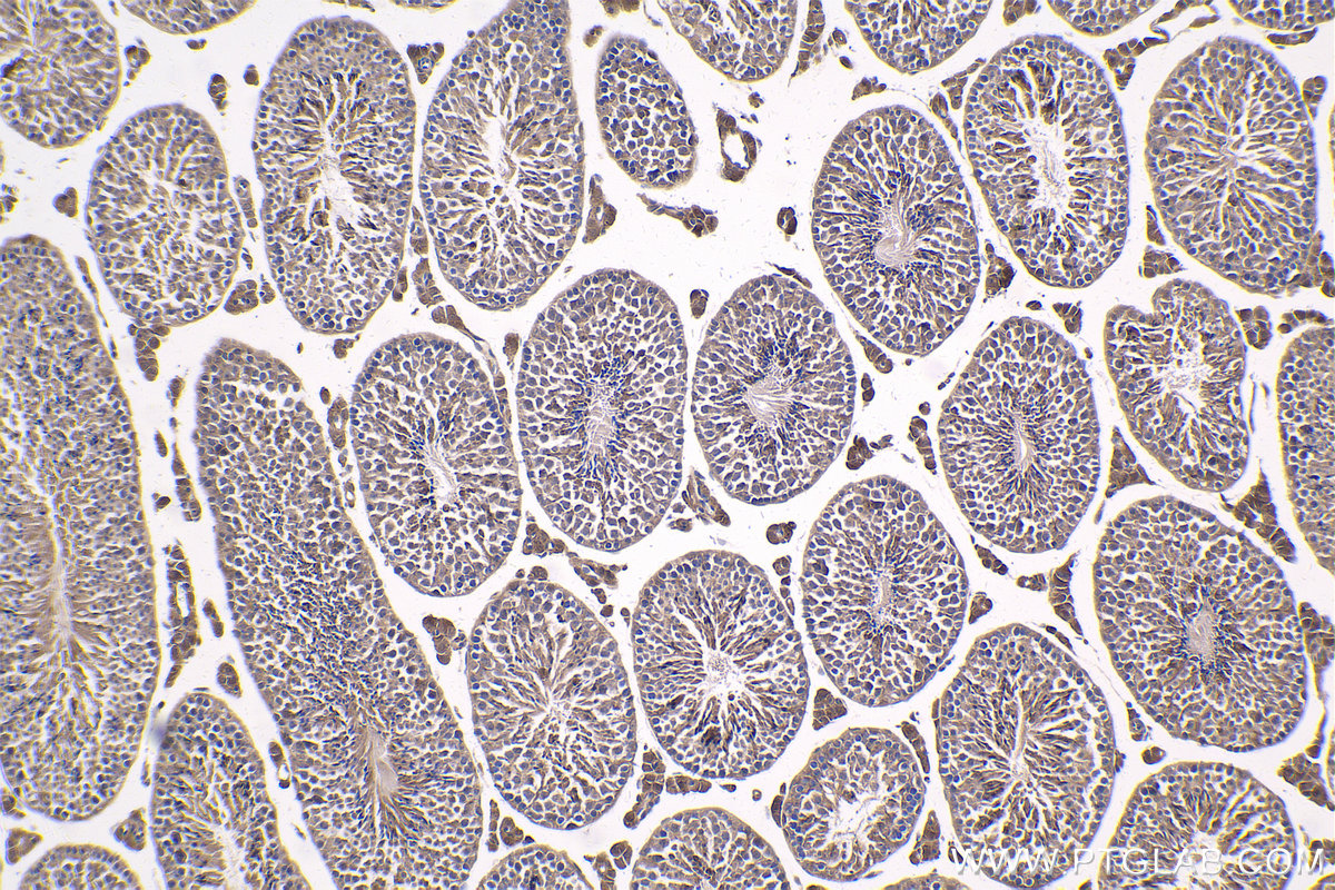 Immunohistochemical analysis of paraffin-embedded mouse testis tissue slide using KHC1757 (ADRM1 IHC Kit).