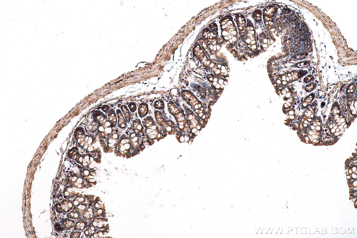 Immunohistochemical analysis of paraffin-embedded mouse colon tissue slide using KHC0797 (AGO2/EIF2C2 IHC Kit).