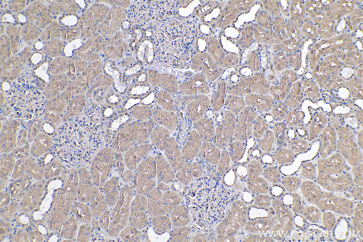 Immunohistochemical analysis of paraffin-embedded human kidney tissue slide using KHC0507 (AGXT IHC Kit).