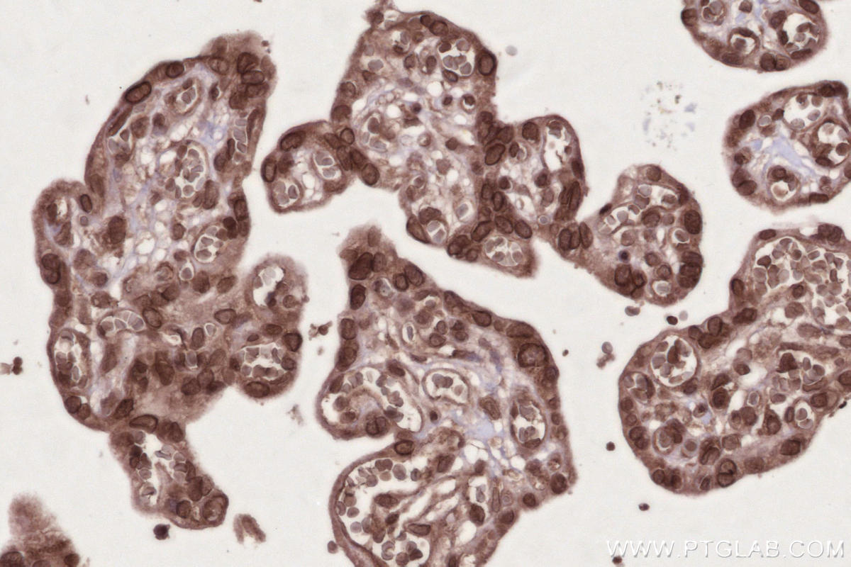 Immunohistochemical analysis of paraffin-embedded human placenta tissue slide using KHC2744 (AHCTF1 IHC Kit). Immunohistochemical analysis of paraffin-embedded human placenta tissue slide using KHC2744 (AHCTF1 IHC Kit).
