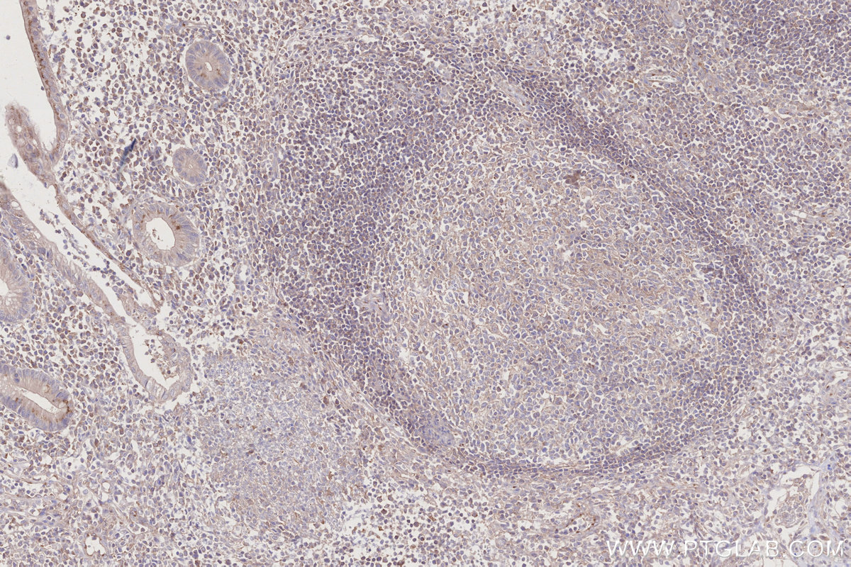 Immunohistochemical analysis of paraffin-embedded human appendicitis tissue slide using KHC2796 (AHCYL2 IHC Kit).