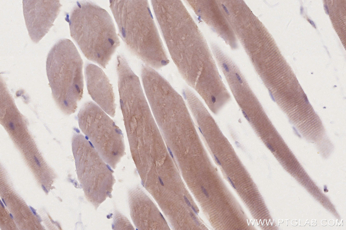 Immunohistochemical analysis of paraffin-embedded mouse skeletal muscle tissue slide using KHC2796 (AHCYL2 IHC Kit).