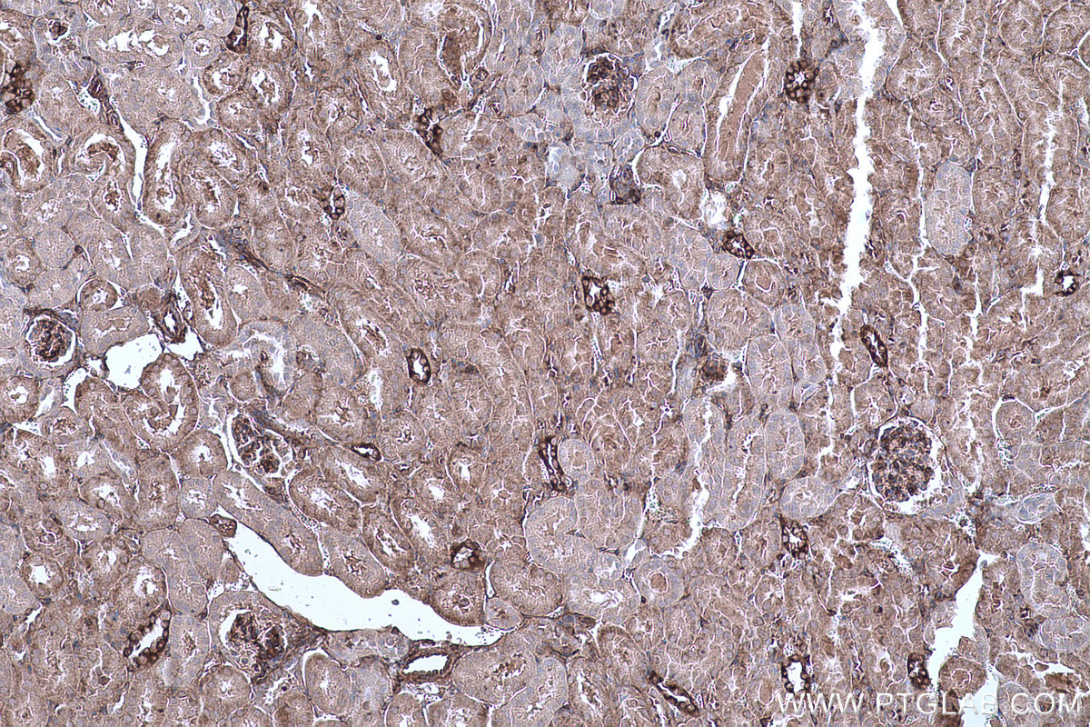 Immunohistochemical analysis of paraffin-embedded mouse kidney tissue slide using KHC0658 (AHNAK IHC Kit).