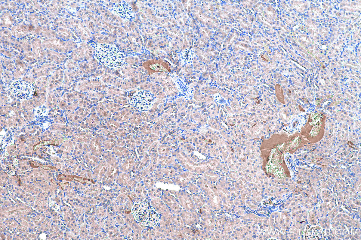 Immunohistochemical analysis of paraffin-embedded rat kidney tissue slide using KHC0483 (AHSG/Fetuin A IHC Kit).