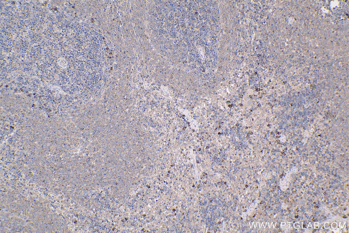 Immunohistochemical analysis of paraffin-embedded rat spleen tissue slide using KHC1430 (AIM2 IHC Kit).