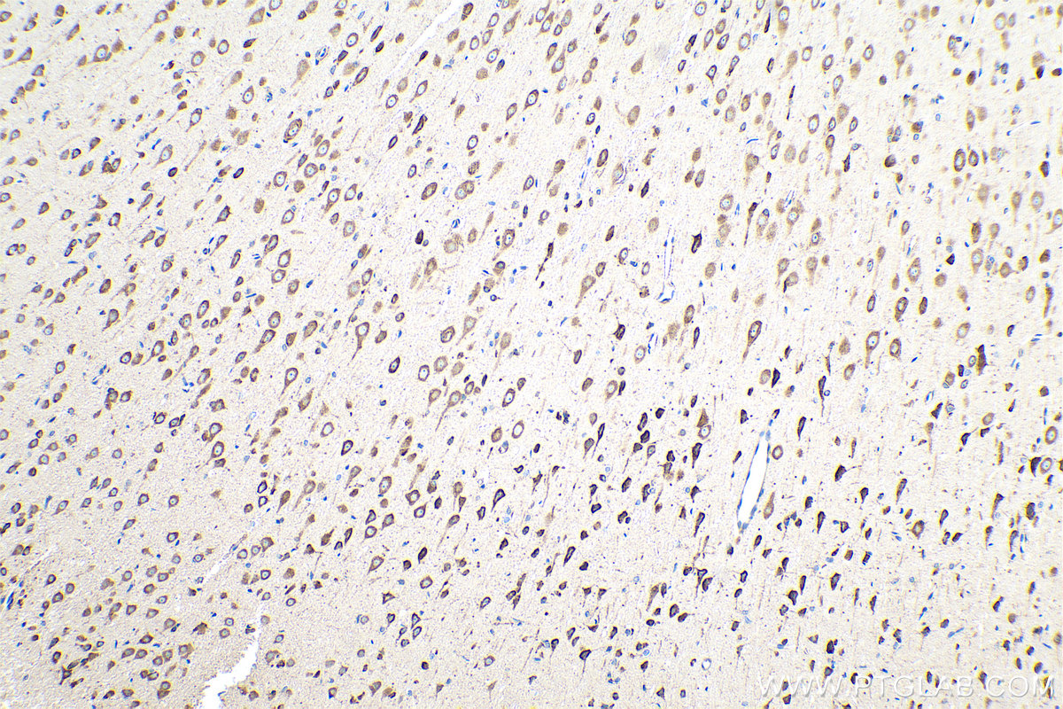 Immunohistochemical analysis of paraffin-embedded rat brain tissue slide using KHC0845 (AIMP1 IHC Kit).