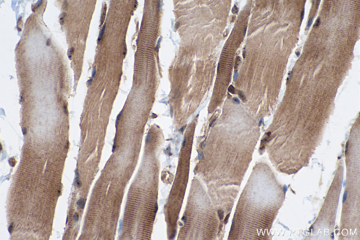 Immunohistochemical analysis of paraffin-embedded rat skeletal muscle tissue slide using KHC0394 (AIMP2/JTV1 IHC Kit).