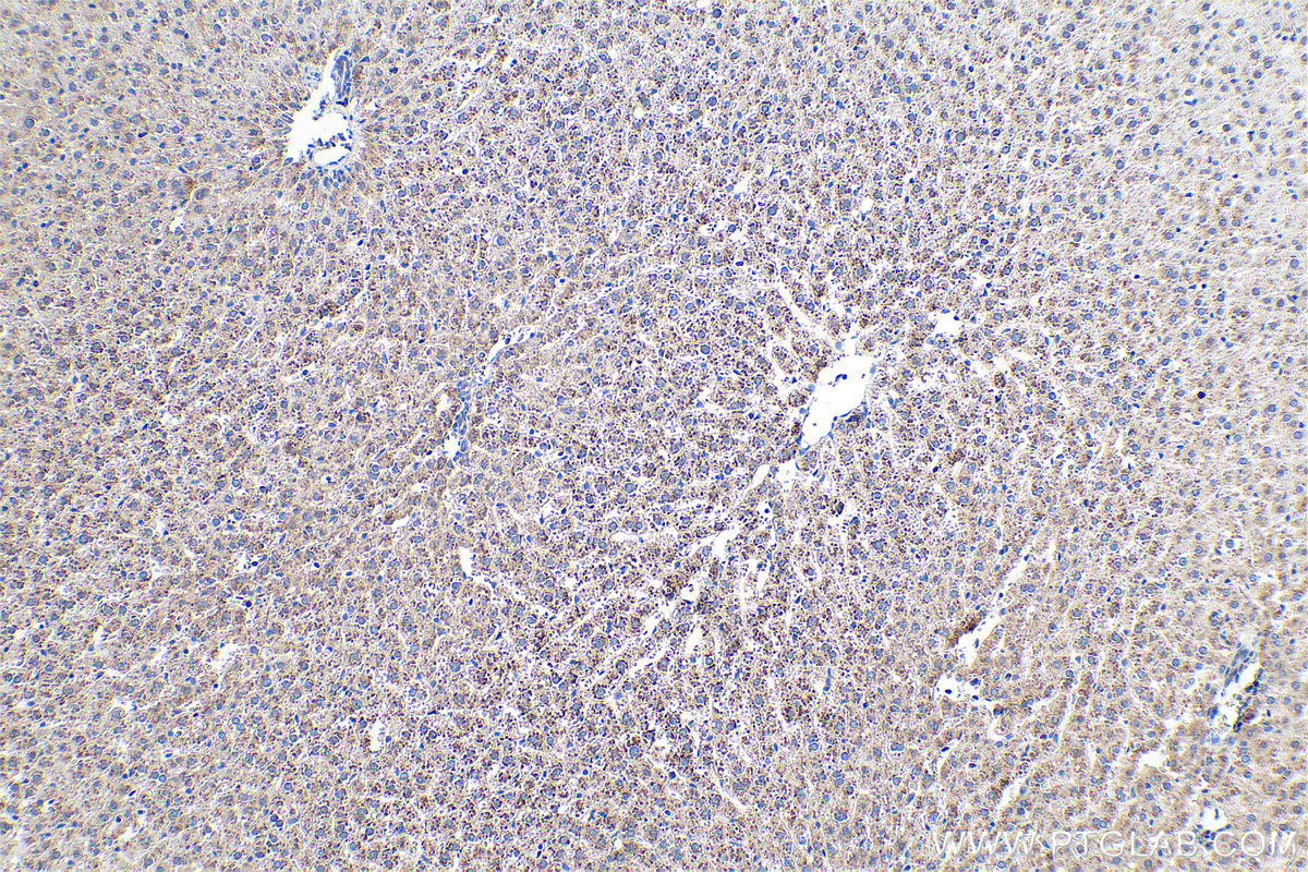 Immunohistochemical analysis of paraffin-embedded rat liver tissue slide using KHC0394 (AIMP2/JTV1 IHC Kit).