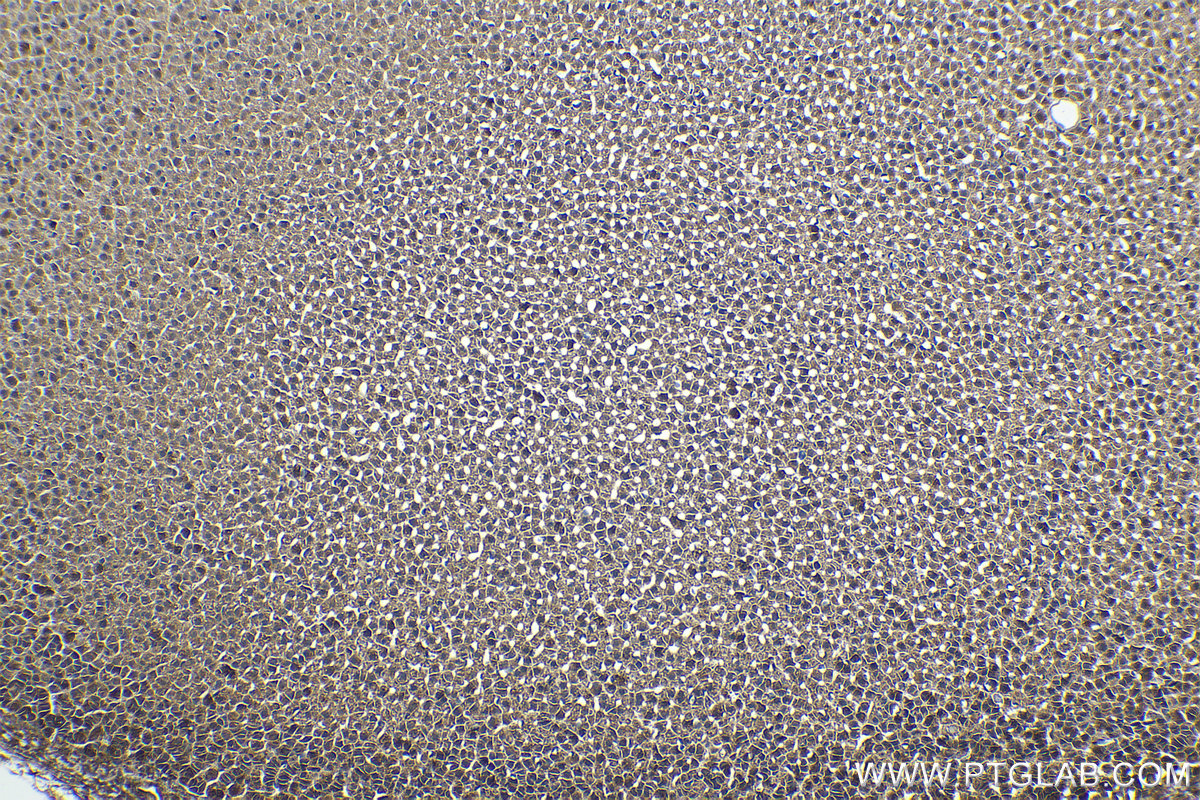 Immunohistochemical analysis of paraffin-embedded rat adrenal gland tissue slide using KHC1459 (AIRE IHC Kit).