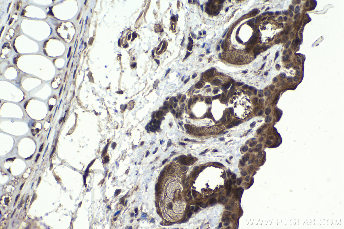 Immunohistochemical analysis of paraffin-embedded mouse skin tissue slide using KHC1873 (AJUBA IHC Kit).