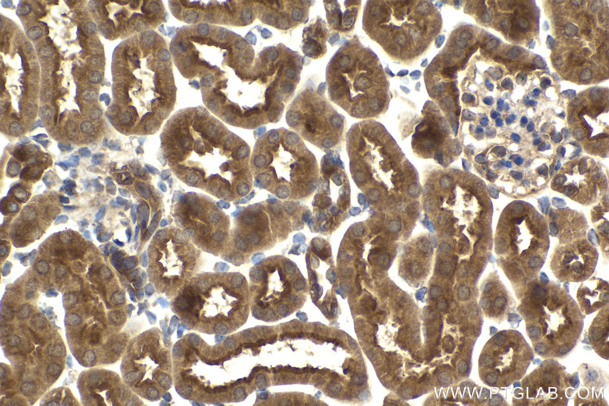 Immunohistochemical analysis of paraffin-embedded mouse kidney tissue slide using KHC2089 (AKAP10 IHC Kit).