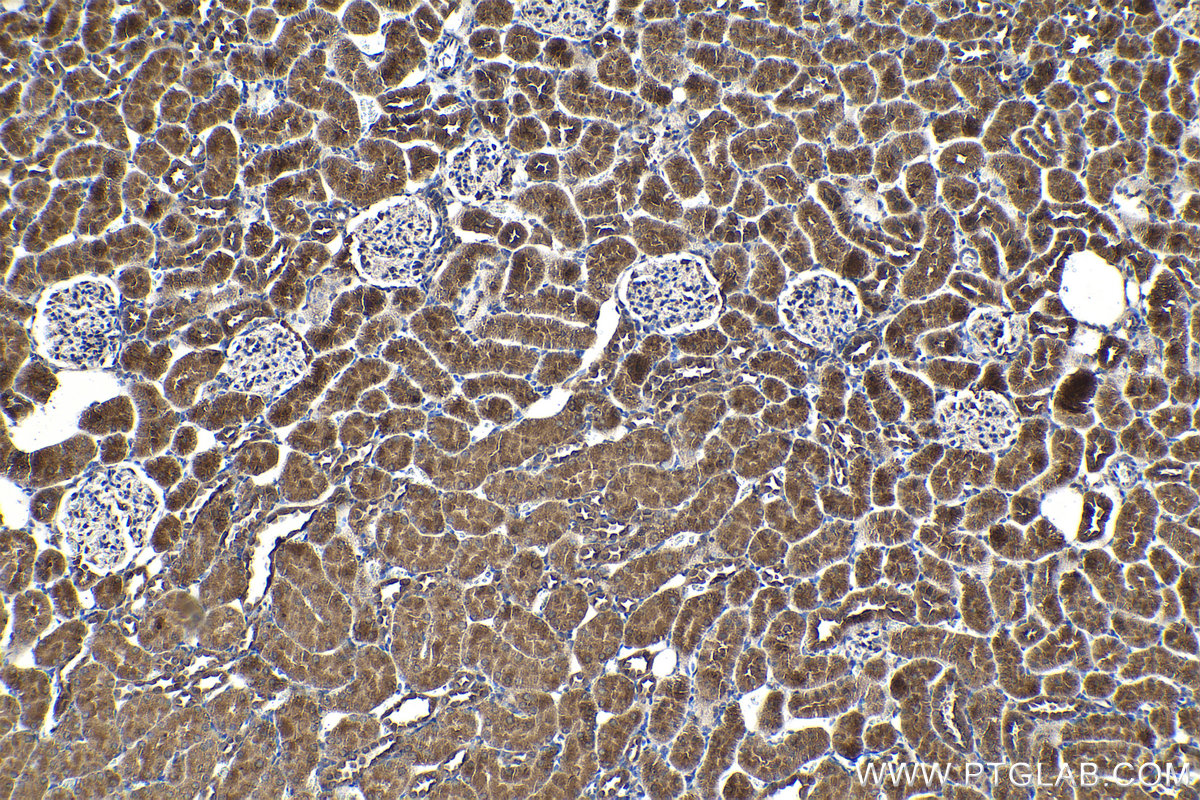 Immunohistochemical analysis of paraffin-embedded rat kidney tissue slide using KHC2089 (AKAP10 IHC Kit).