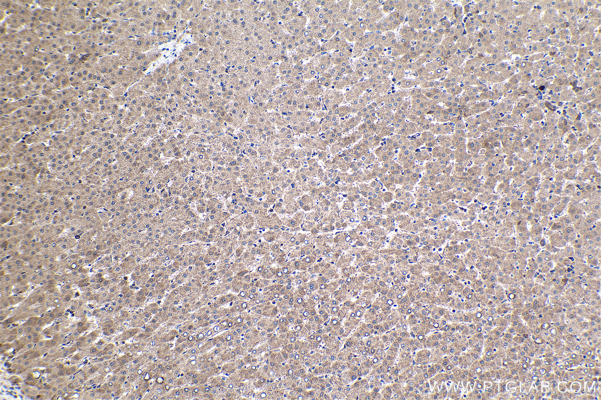 Immunohistochemical analysis of paraffin-embedded human liver tissue slide using KHC1691 (AKAP13 IHC Kit).