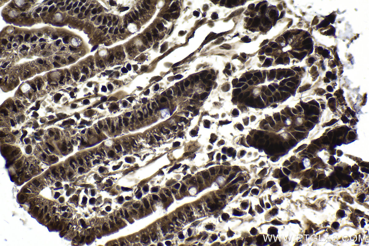 Immunohistochemical analysis of paraffin-embedded mouse small intestine tissue slide using KHC1691 (AKAP13 IHC Kit).