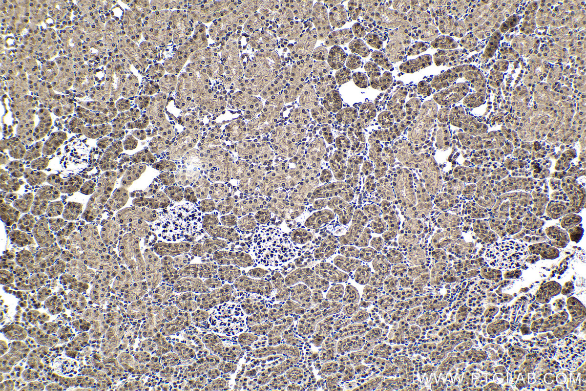 Immunohistochemical analysis of paraffin-embedded rat kidney tissue slide using KHC1691 (AKAP13 IHC Kit).