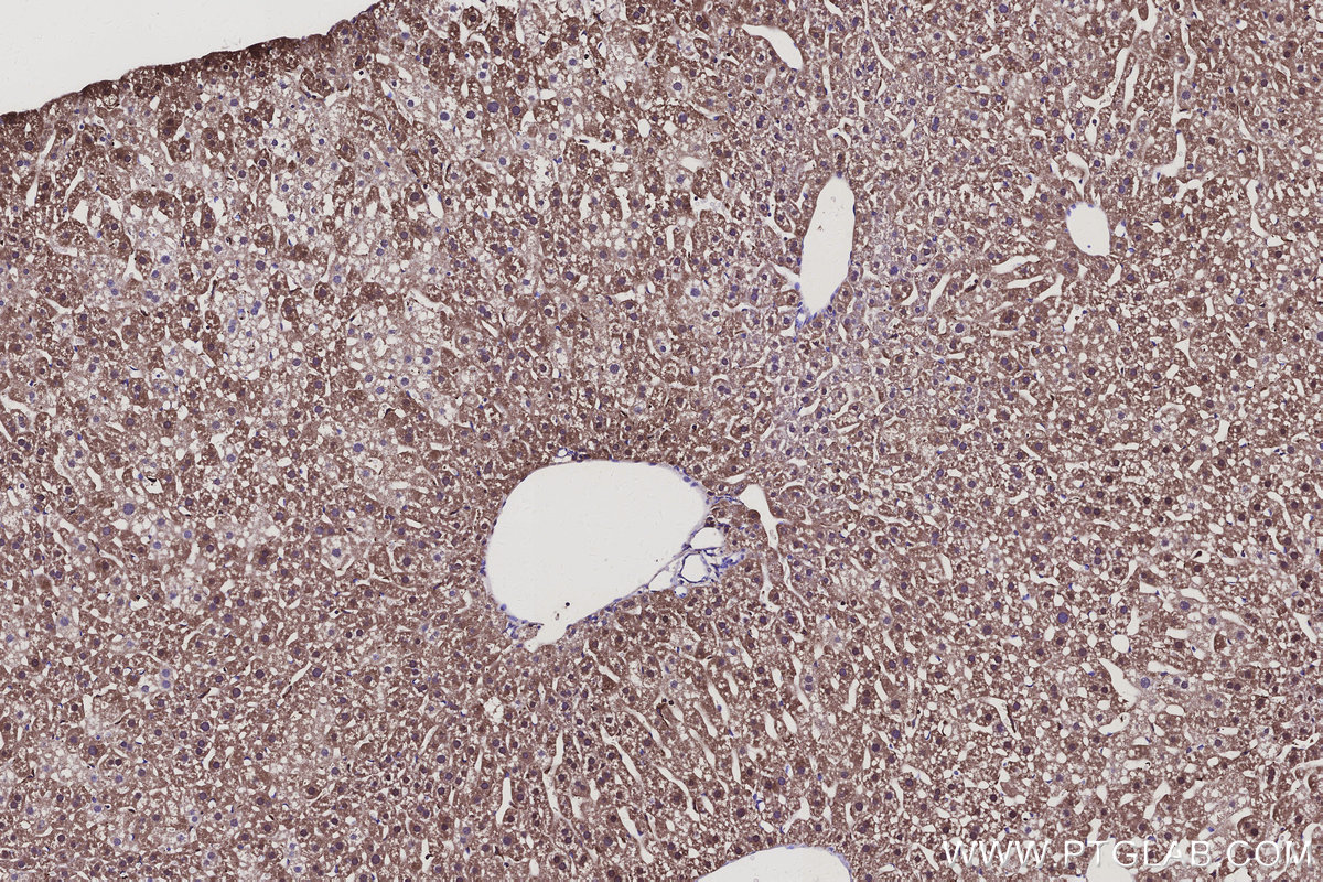 Immunohistochemical analysis of paraffin-embedded mouse liver tissue slide using KHC3143 (AKR7A2 IHC Kit).