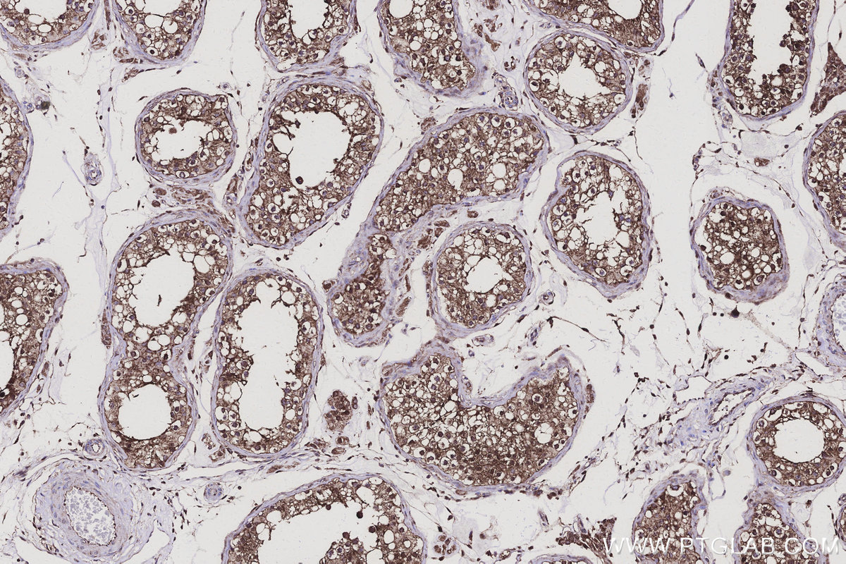 Immunohistochemical analysis of paraffin-embedded human testis tissue slide using KHC3143 (AKR7A2 IHC Kit).