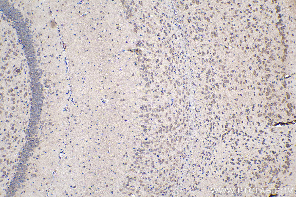 Immunohistochemical analysis of paraffin-embedded rat brain tissue slide using KHC0115 (AKT IHC Kit).