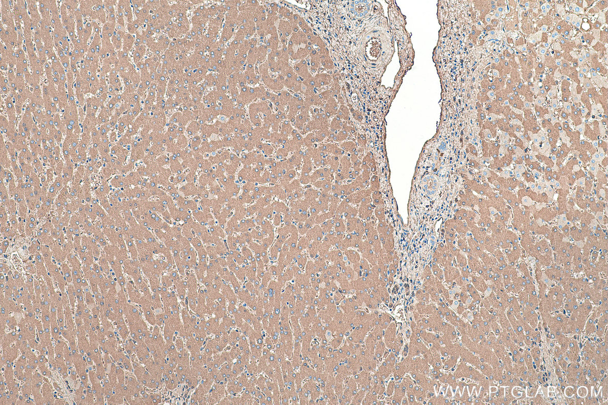 Immunohistochemical analysis of paraffin-embedded human liver tissue slide using KHC0376 (ALB IHC Kit).