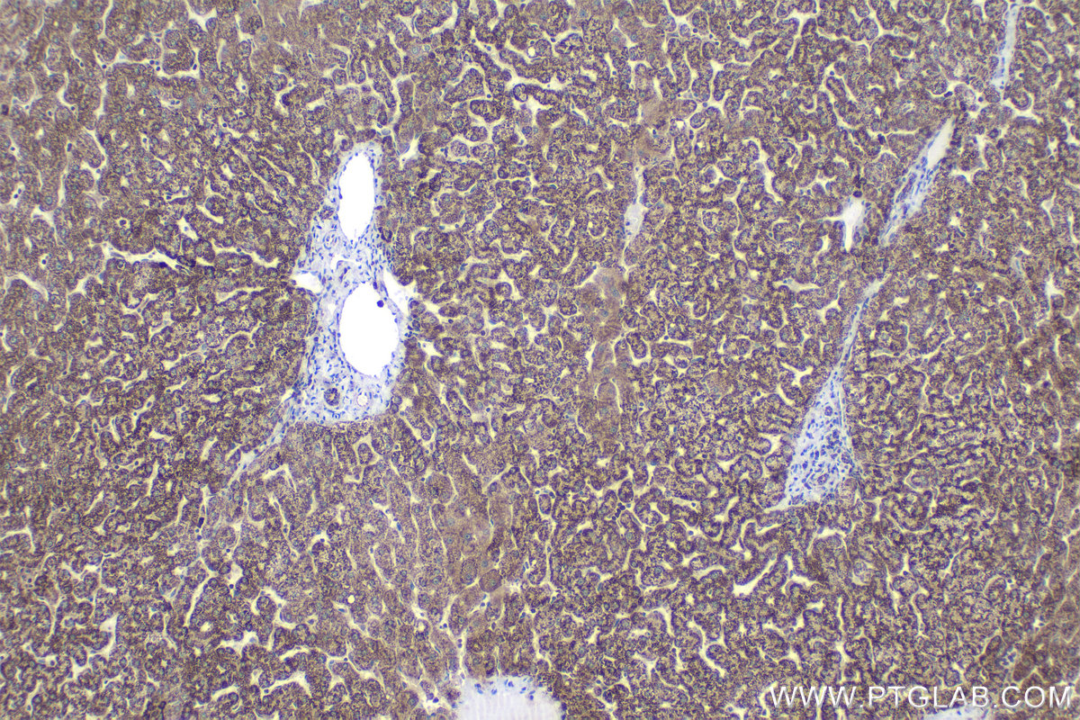 Immunohistochemical analysis of paraffin-embedded human liver tissue slide using KHC1045 (ALDH1B1 IHC Kit).