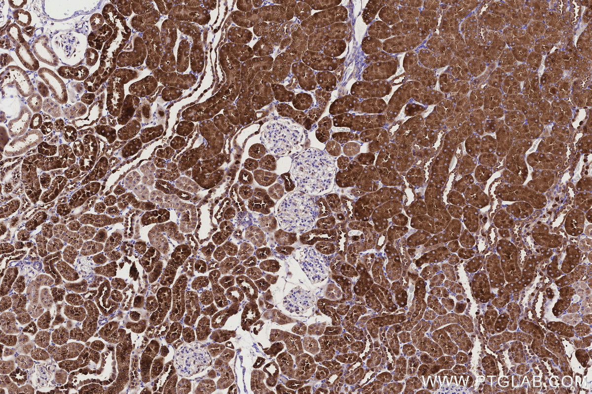 Immunohistochemical analysis of paraffin-embedded rat kidney tissue slide using KHC3151 (ALDH1L1 IHC Kit).