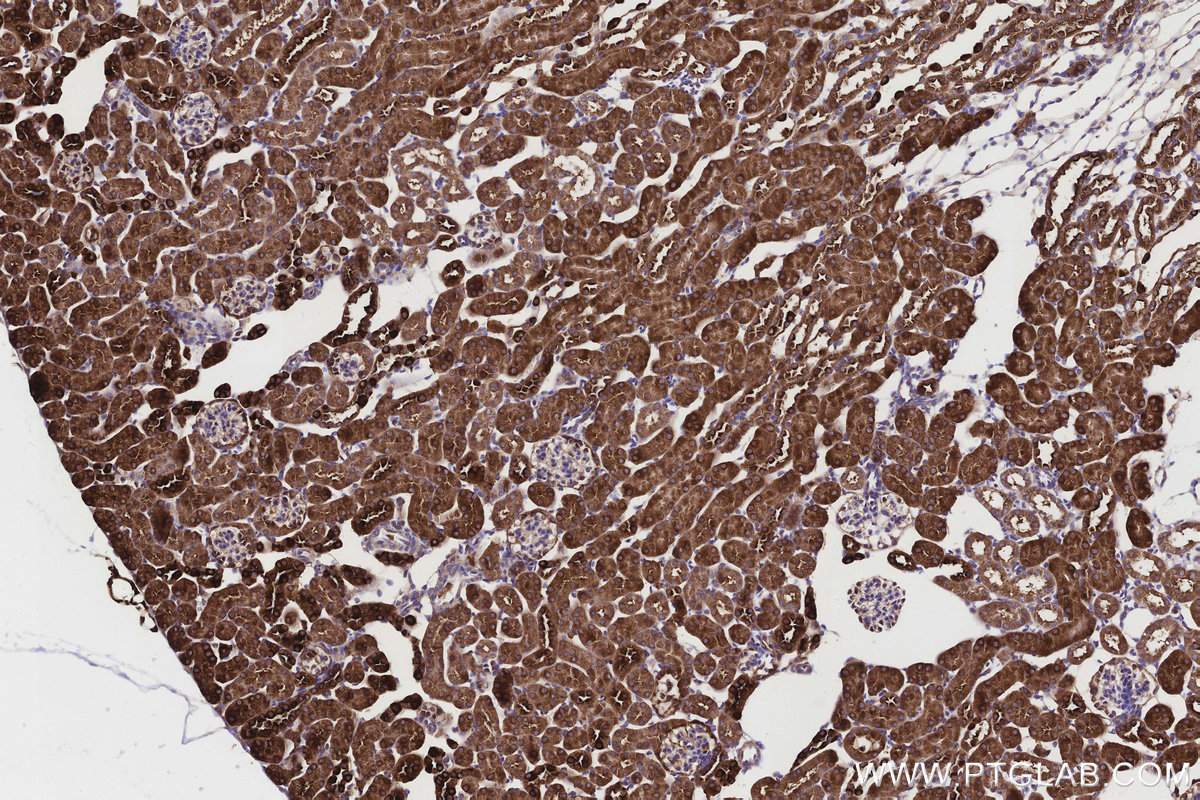 Immunohistochemical analysis of paraffin-embedded mouse kidney tissue slide using KHC3151 (ALDH1L1 IHC Kit).