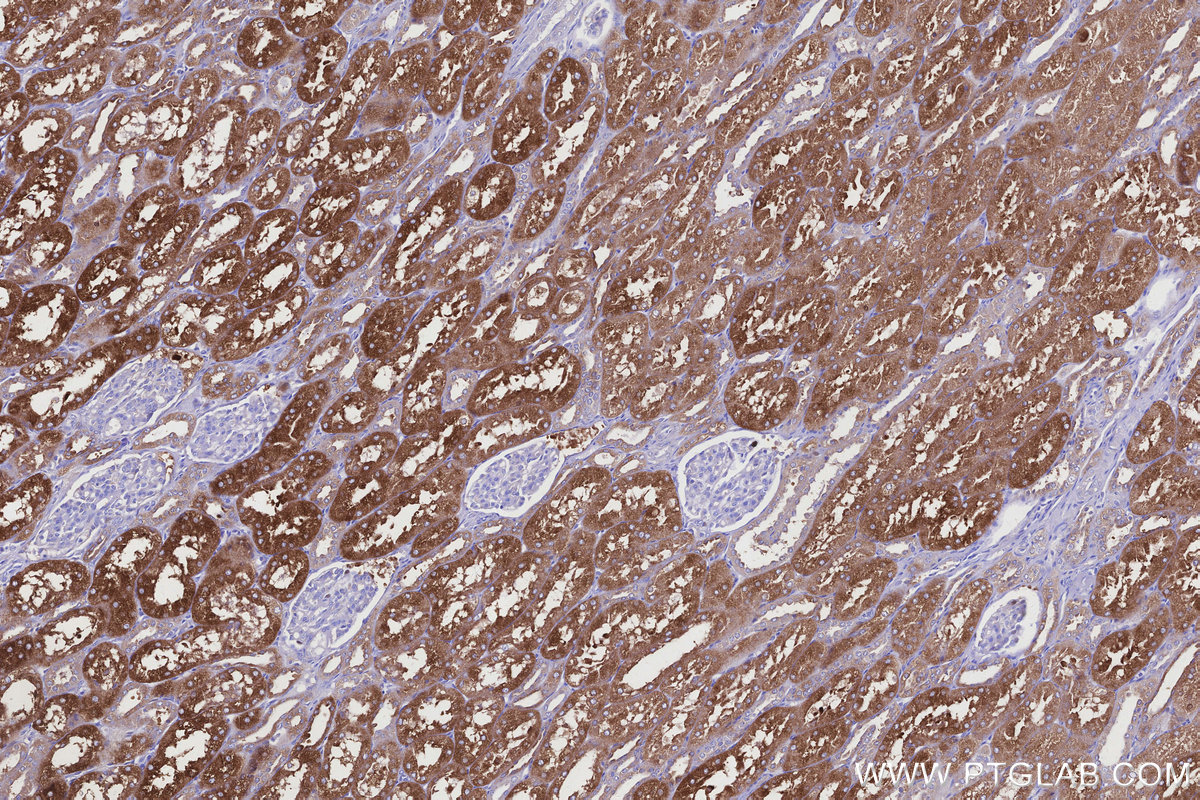 Immunohistochemical analysis of paraffin-embedded human kidney tissue slide using KHC3151 (ALDH1L1 IHC Kit).
