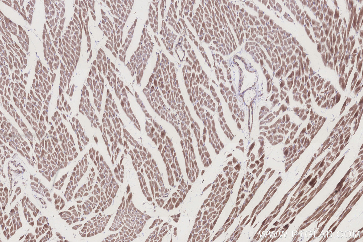 Immunohistochemical analysis of paraffin-embedded rat heart tissue slide using KHC3260 (ALDH1L2 IHC Kit).