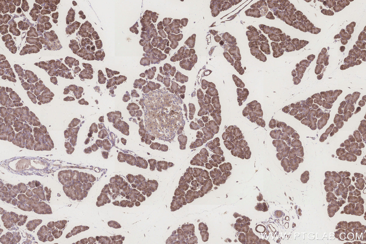 Immunohistochemical analysis of paraffin-embedded rat pancreas tissue slide using KHC3260 (ALDH1L2 IHC Kit).