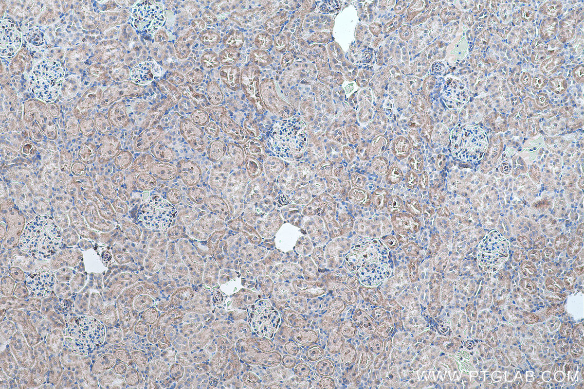 Immunohistochemical analysis of paraffin-embedded rat kidney tissue slide using KHC0506 (ALDH2 IHC Kit).