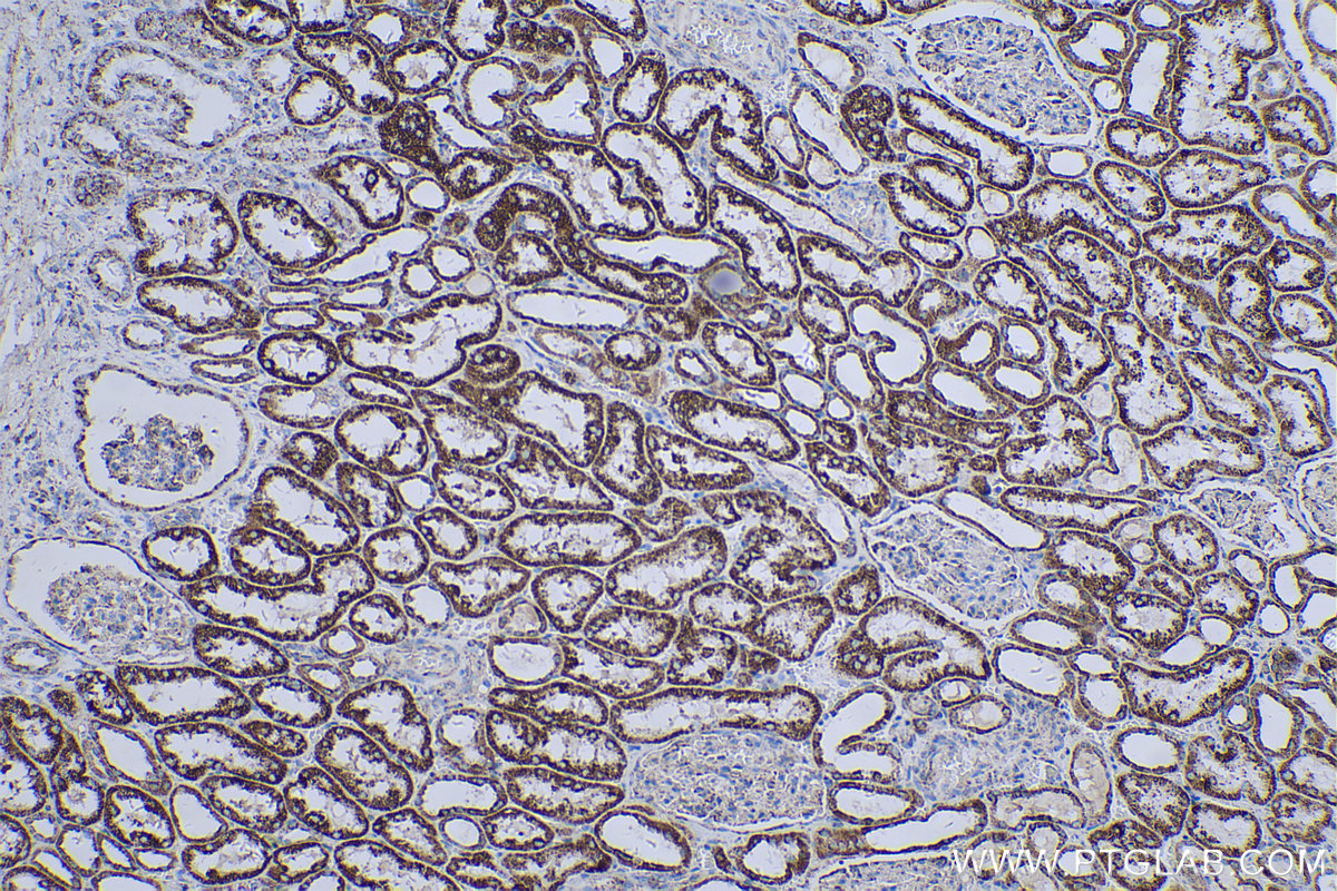Immunohistochemical analysis of paraffin-embedded human kidney tissue slide using KHC0545 (ALDH6A1 IHC Kit).