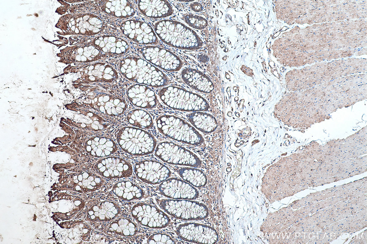 Immunohistochemical analysis of paraffin-embedded human colon tissue slide using KHC0488 (ALDOA IHC Kit).