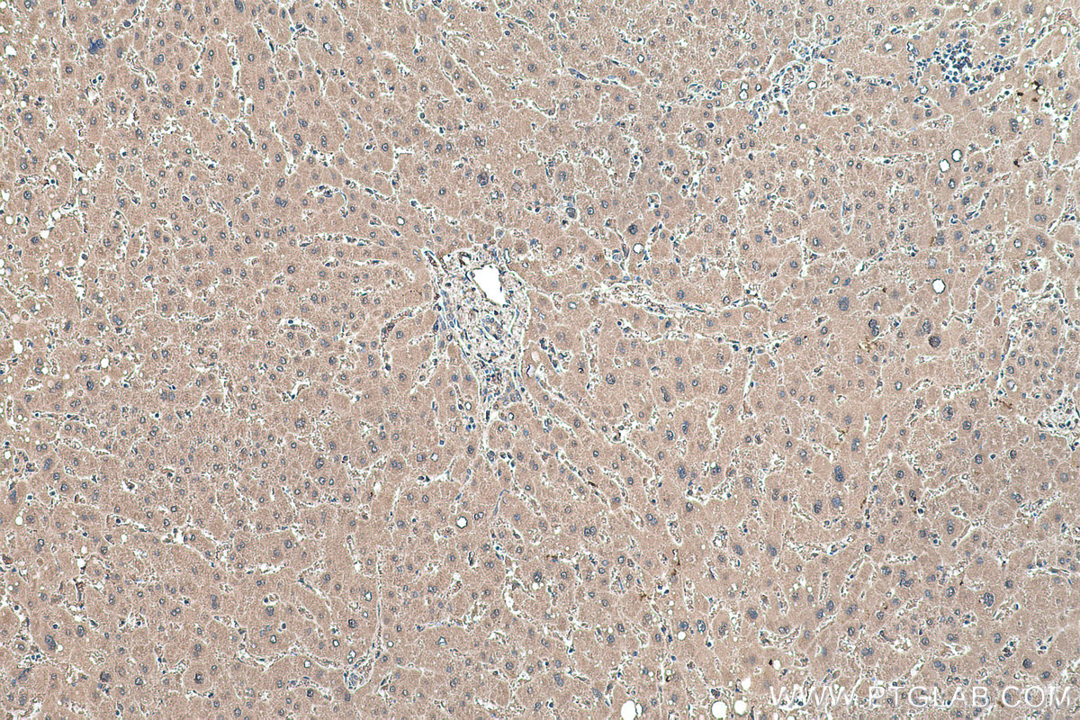 Immunohistochemical analysis of paraffin-embedded human liver tissue slide using KHC0488 (ALDOA IHC Kit).