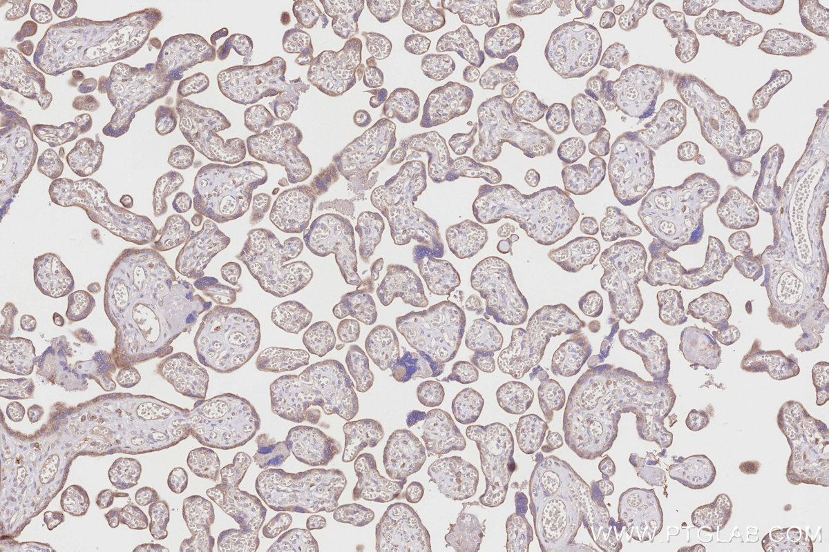 Immunohistochemical analysis of paraffin-embedded human placenta tissue slide using KHC2863 (ALG1 IHC Kit).