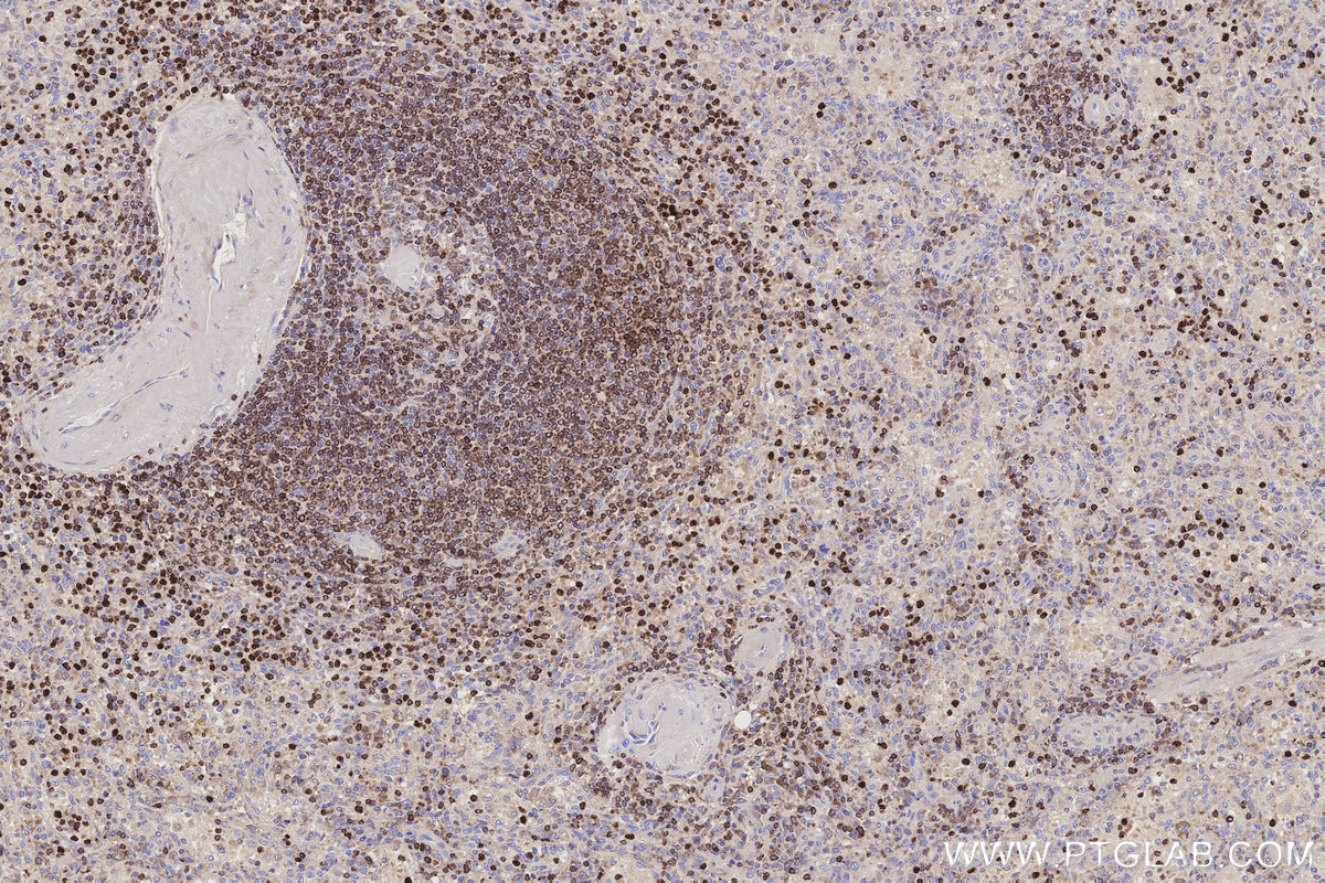 Immunohistochemical analysis of paraffin-embedded human spleen tissue slide using KHC3197 (ALOX5AP IHC Kit). Immunohistochemical analysis of paraffin-embedded human spleen tissue slide using KHC3197 (ALOX5AP IHC Kit).