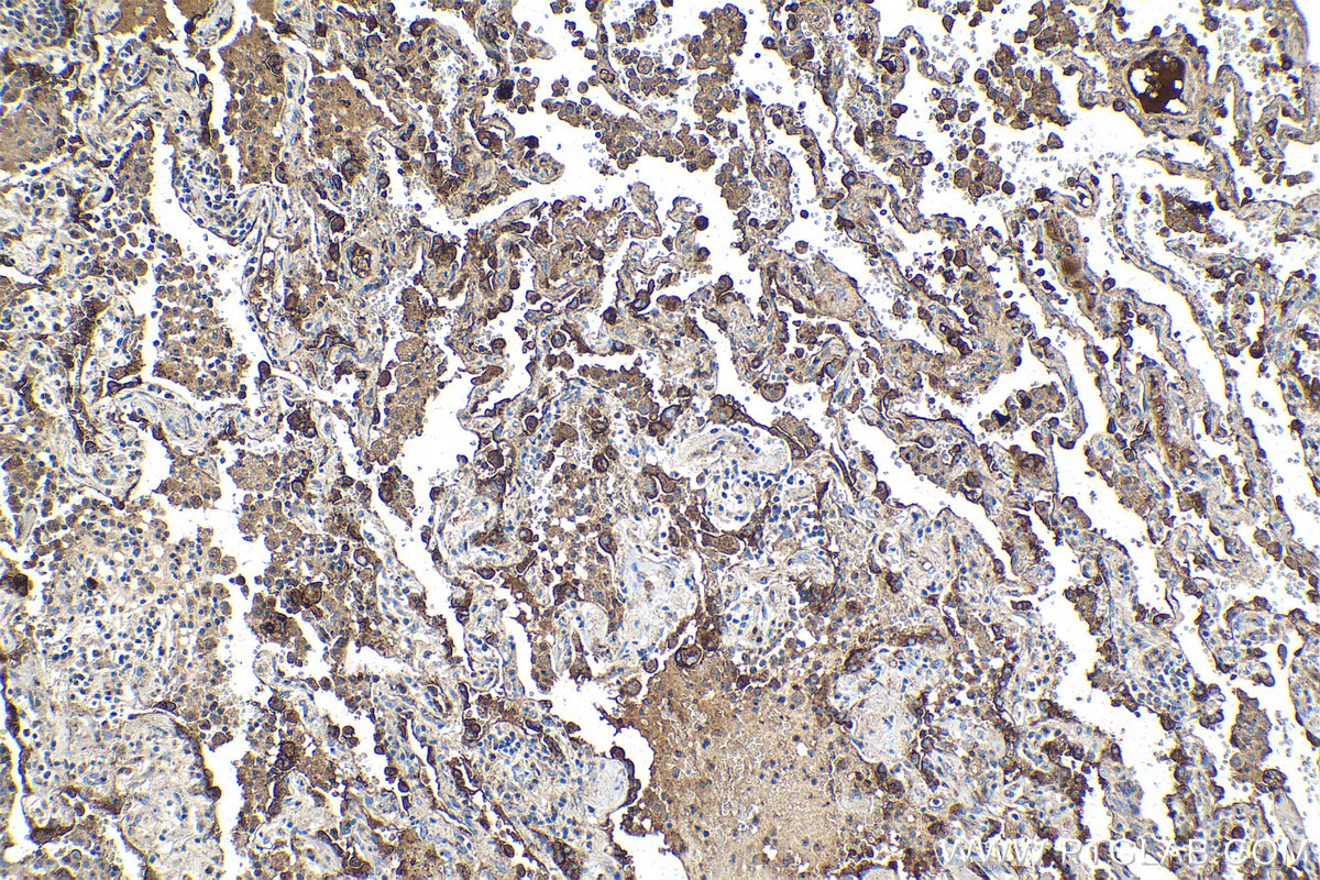 Immunohistochemical analysis of paraffin-embedded human lung tissue slide using KHC2160 (ALPL IHC Kit).