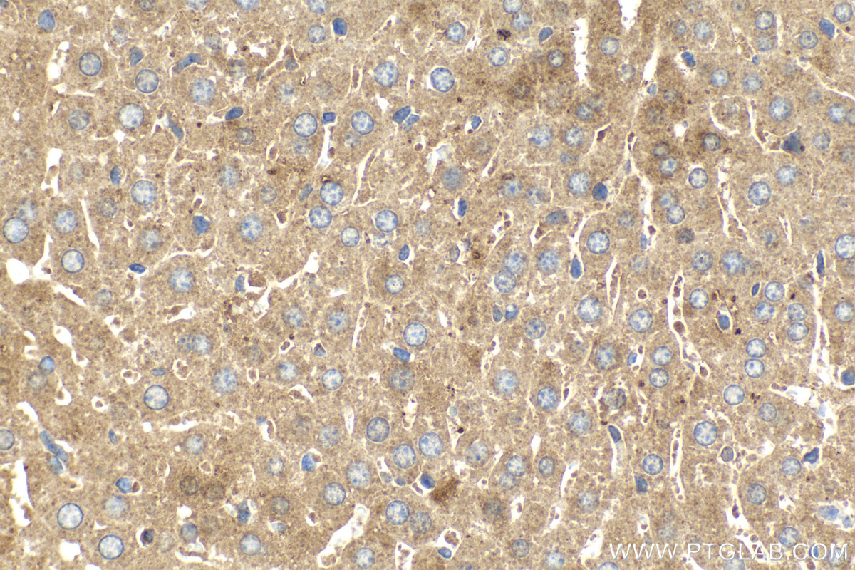 Immunohistochemical analysis of paraffin-embedded mouse liver tissue slide using KHC2160 (ALPL IHC Kit).