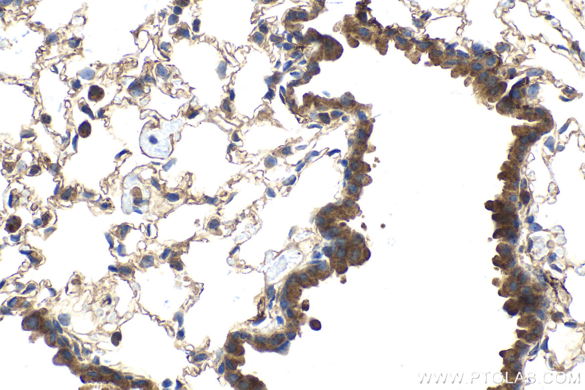 Immunohistochemical analysis of paraffin-embedded mouse lung tissue slide using KHC2160 (ALPL IHC Kit).