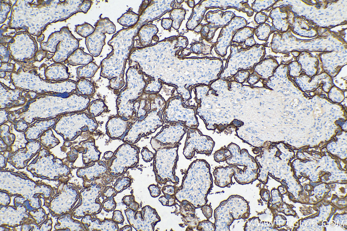 Immunohistochemical analysis of paraffin-embedded human placenta tissue slide using KHC0319 (ALPP/PLAP IHC Kit).