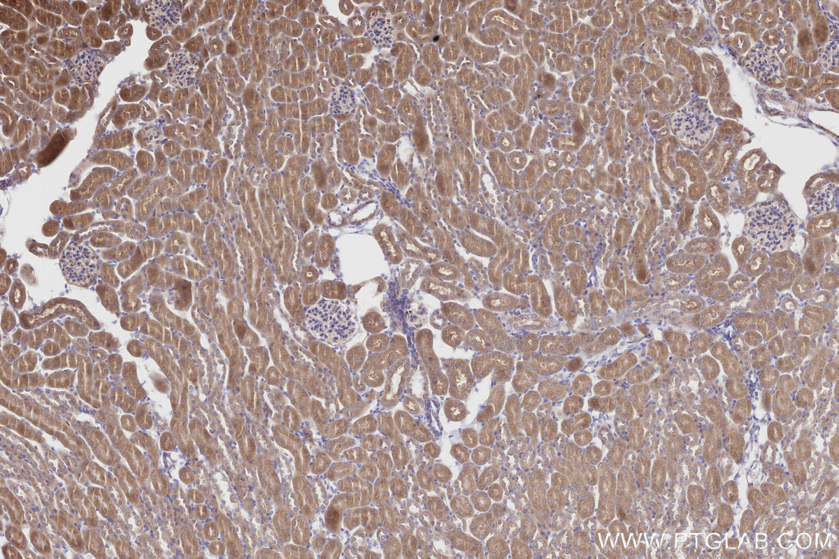 Immunohistochemical analysis of paraffin-embedded mouse kidney tissue slide using KHC2819 (ALS2 IHC Kit).
