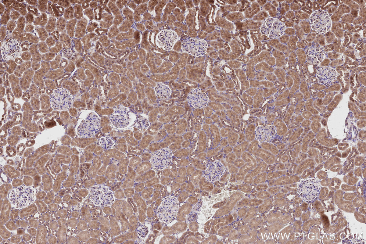 Immunohistochemical analysis of paraffin-embedded rat kidney tissue slide using KHC2819 (ALS2 IHC Kit).