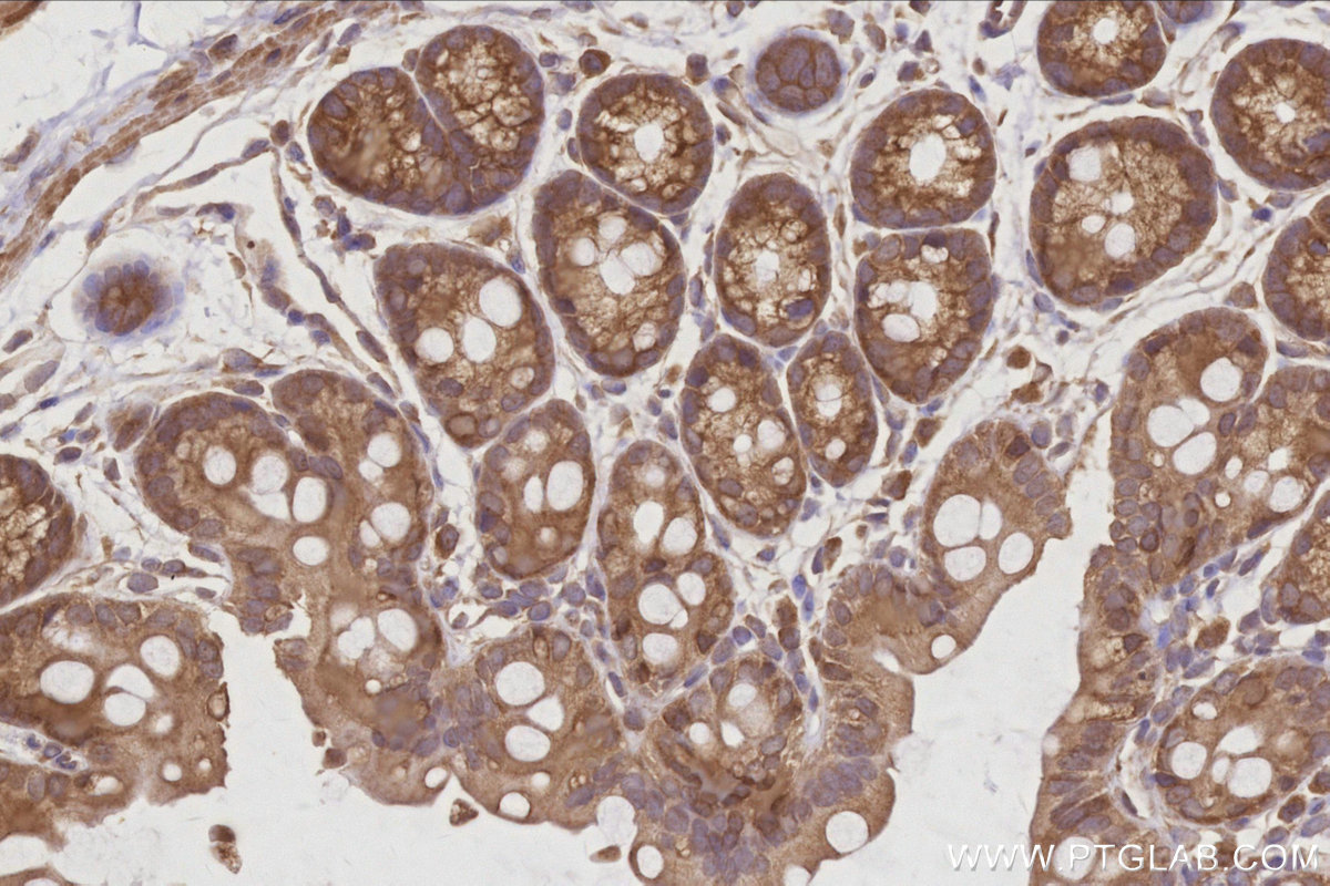 Immunohistochemical analysis of paraffin-embedded mouse colon tissue slide using KHC3030 (AMFR/GP78 IHC Kit).