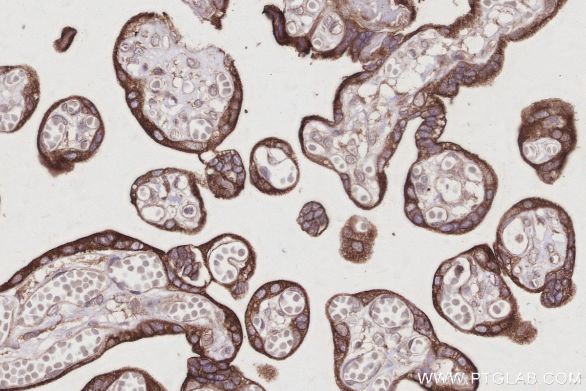 Immunohistochemical analysis of paraffin-embedded human placenta tissue slide using KHC3030 (AMFR/GP78 IHC Kit).
