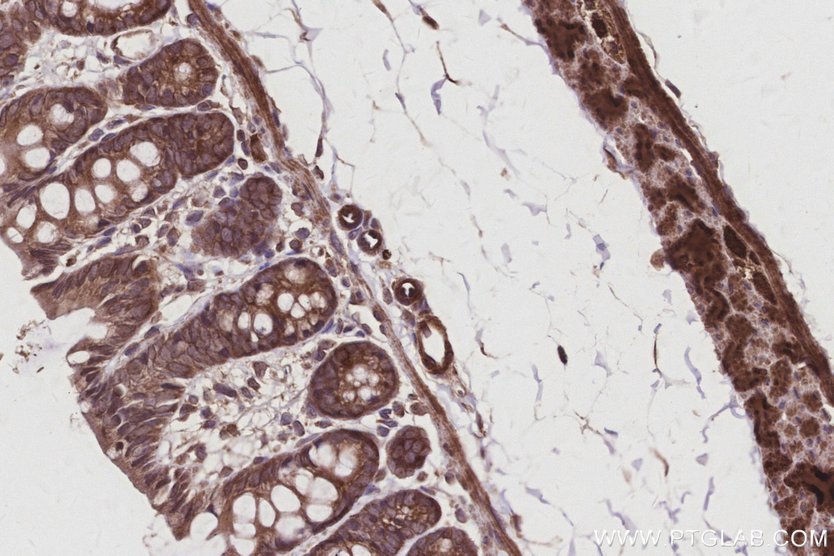 Immunohistochemical analysis of paraffin-embedded rat colon tissue slide using KHC3030 (AMFR/GP78 IHC Kit).