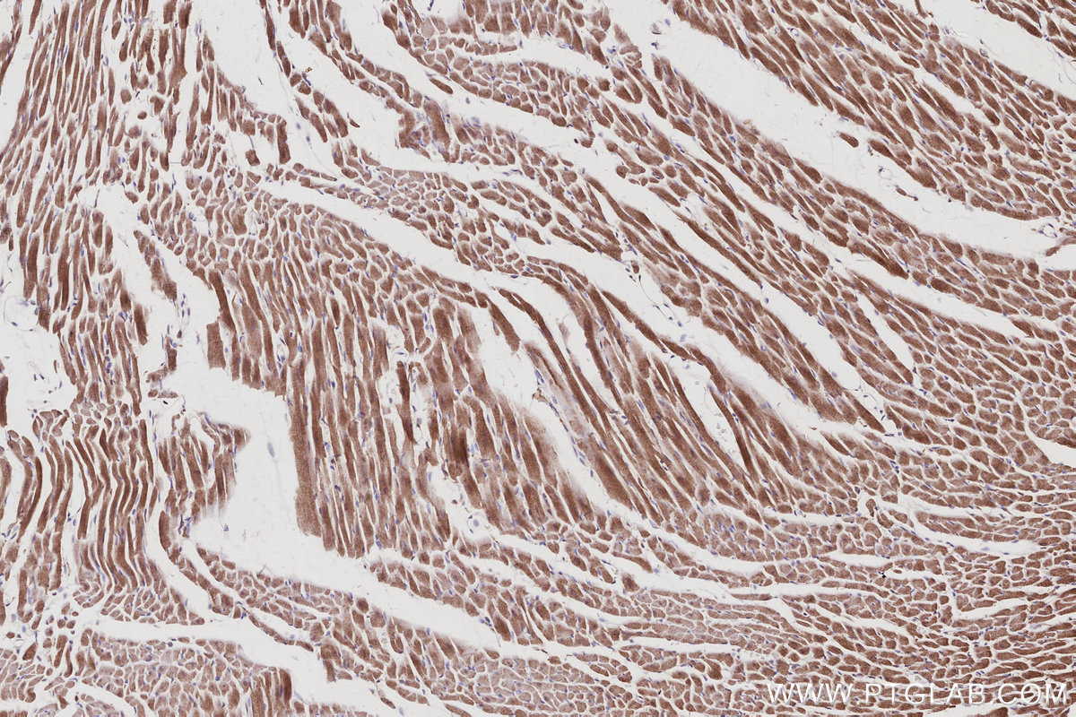 Immunohistochemical analysis of paraffin-embedded rat heart tissue slide using KHC3040 (ANAPC10 IHC Kit).