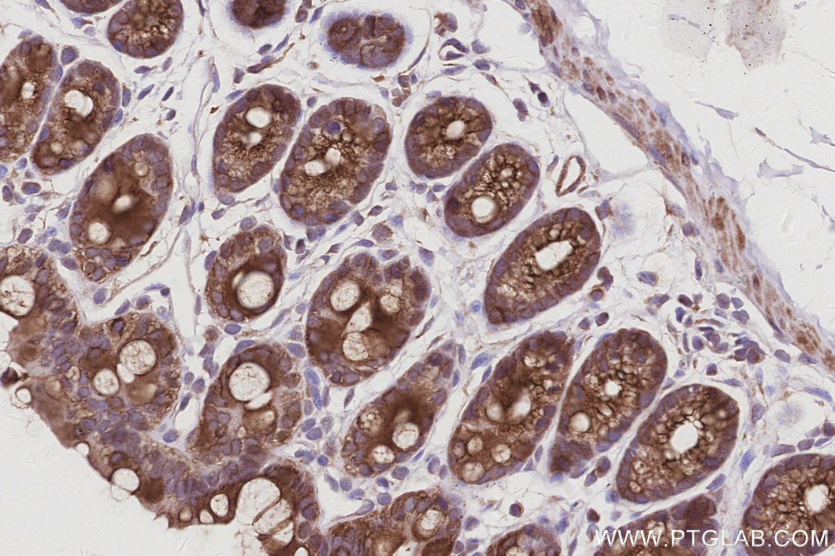 Immunohistochemical analysis of paraffin-embedded mouse colon tissue slide using KHC3040 (ANAPC10 IHC Kit).