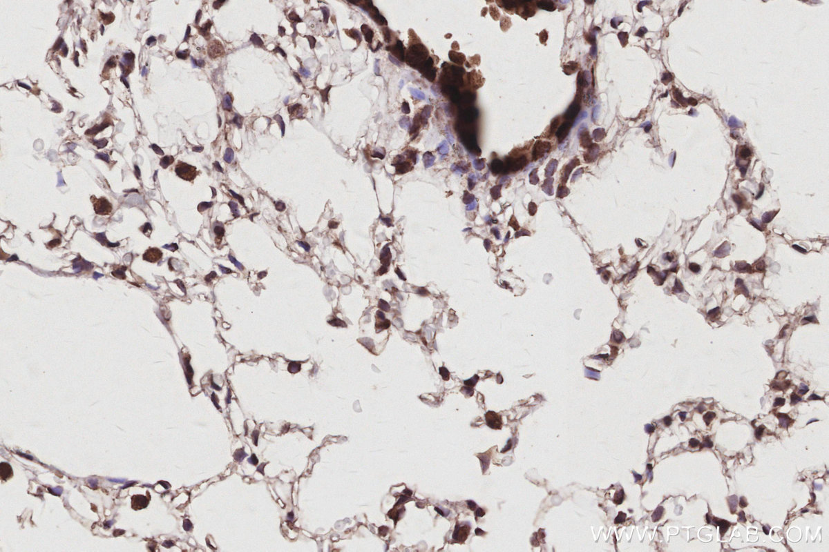 Immunohistochemical analysis of paraffin-embedded mouse lung tissue slide using KHC3021 (ANAPC5 IHC Kit).